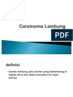 Carsinoma Lambung