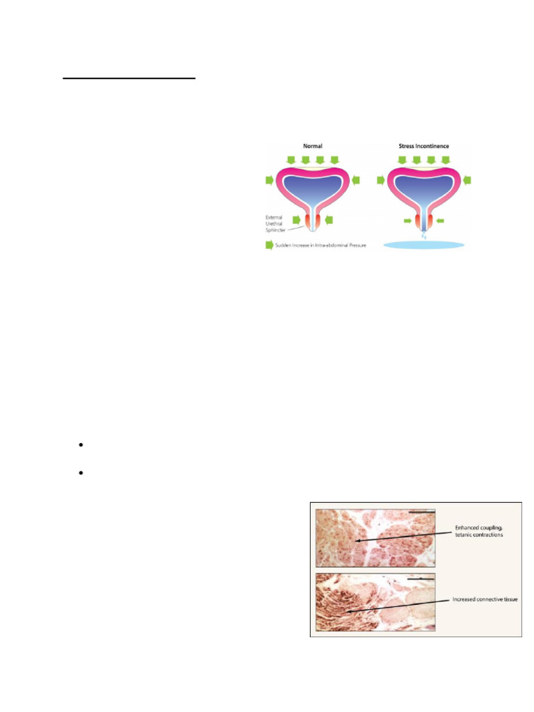 Week+12 Urinary+System+Disorders | PDF | Urinary Incontinence | Urination