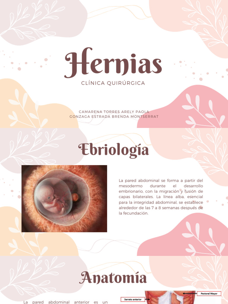 Tipos y Tratamientos de Hernias Abdominales | PDF | Abdomen