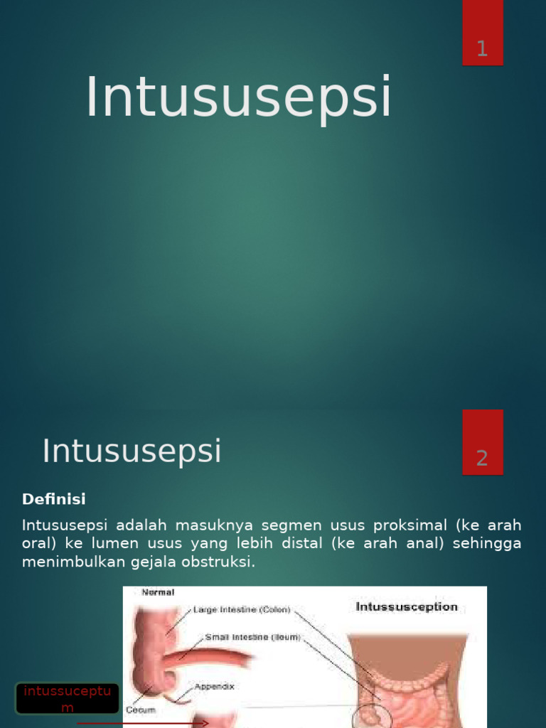 Intus Use Psi | PDF