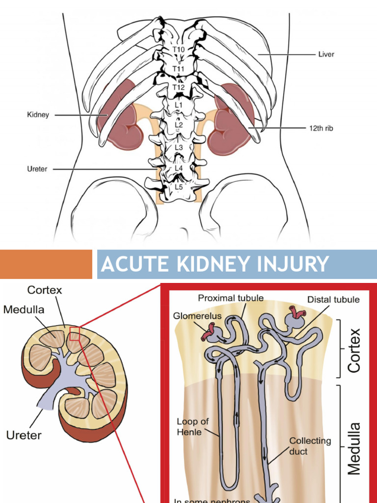 Understanding Acute Kidney Injury | PDF | Kidney | Chronic Kidney Disease