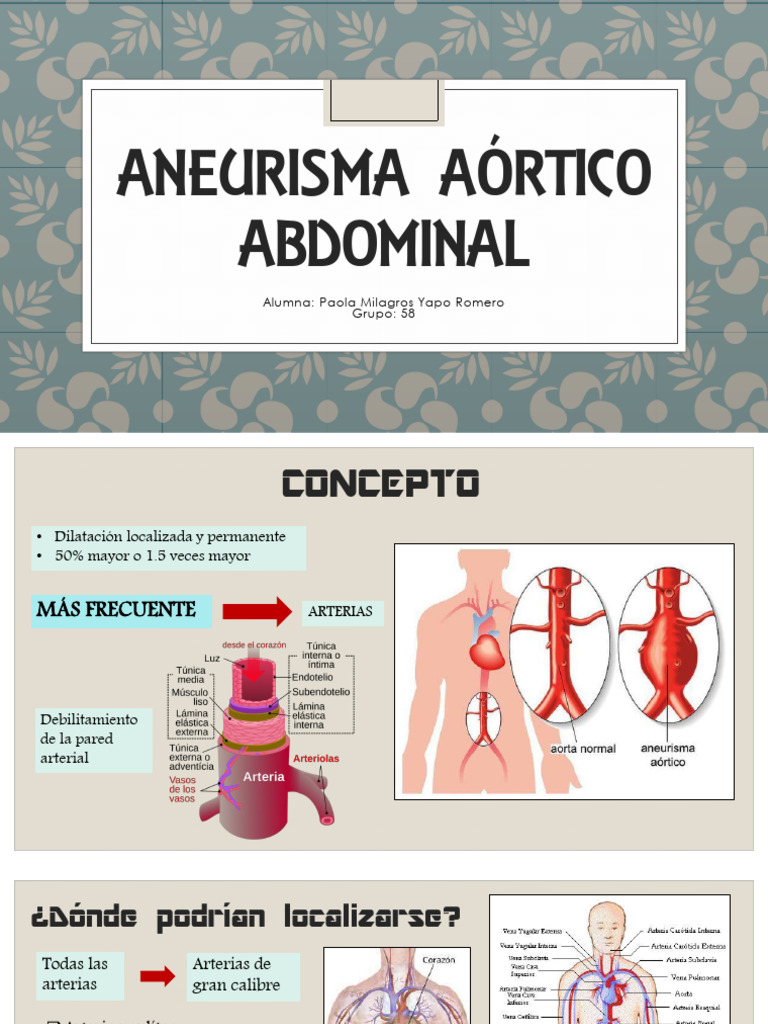 Aneurisma Aórtico Abdominal | PDF | Angiología | Sistema cardiovascular