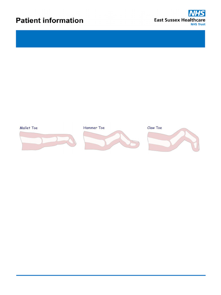 Managing Lesser Toe Deformities | PDF | Toe | Foot