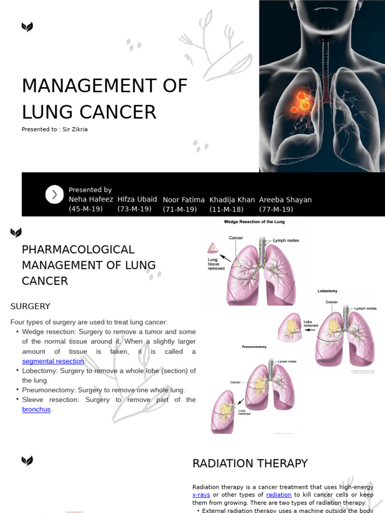 Lung Cancer Management | PDF | Cancer | Radiation Therapy