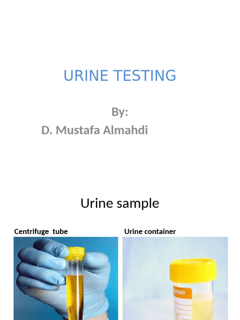 Urine Testing and Analysis Guide | PDF | Medical Specialties