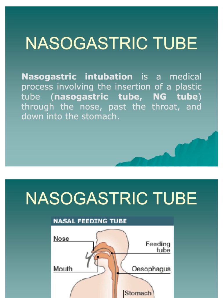 Nasogastric Tube Gastroenterology Medical Specialties