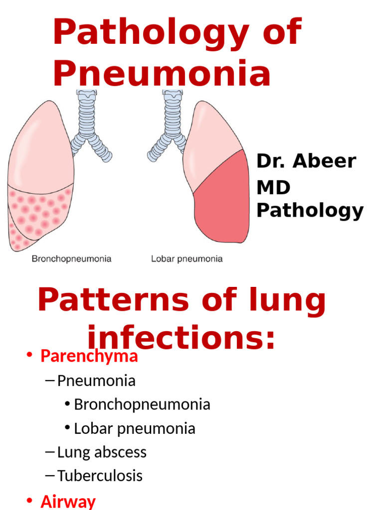 Pneumonia Pathology Overview and Types | PDF | Pneumonia | Tuberculosis