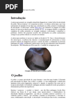 Como Funciona a Artroscopia Do Joelho