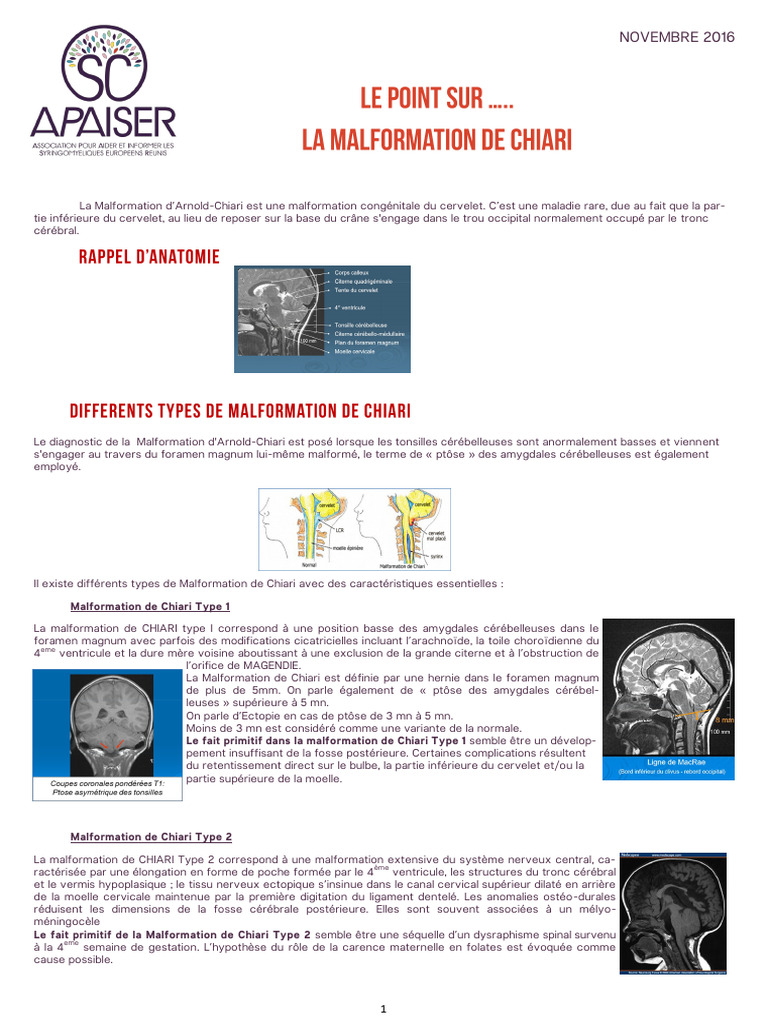 Malformation de Chiari Type 1 : Diagnostic et Traitement | PDF ...