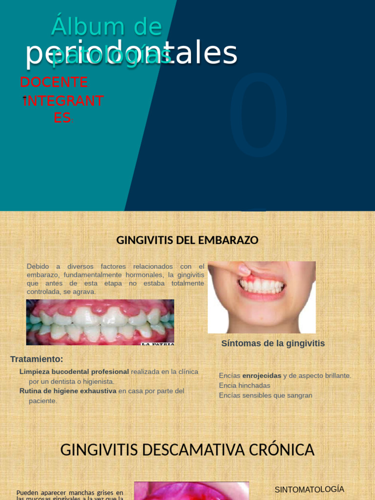 # 4 Periodontitis-1 | PDF | Especialidades Medicas | Enfermedades y ...