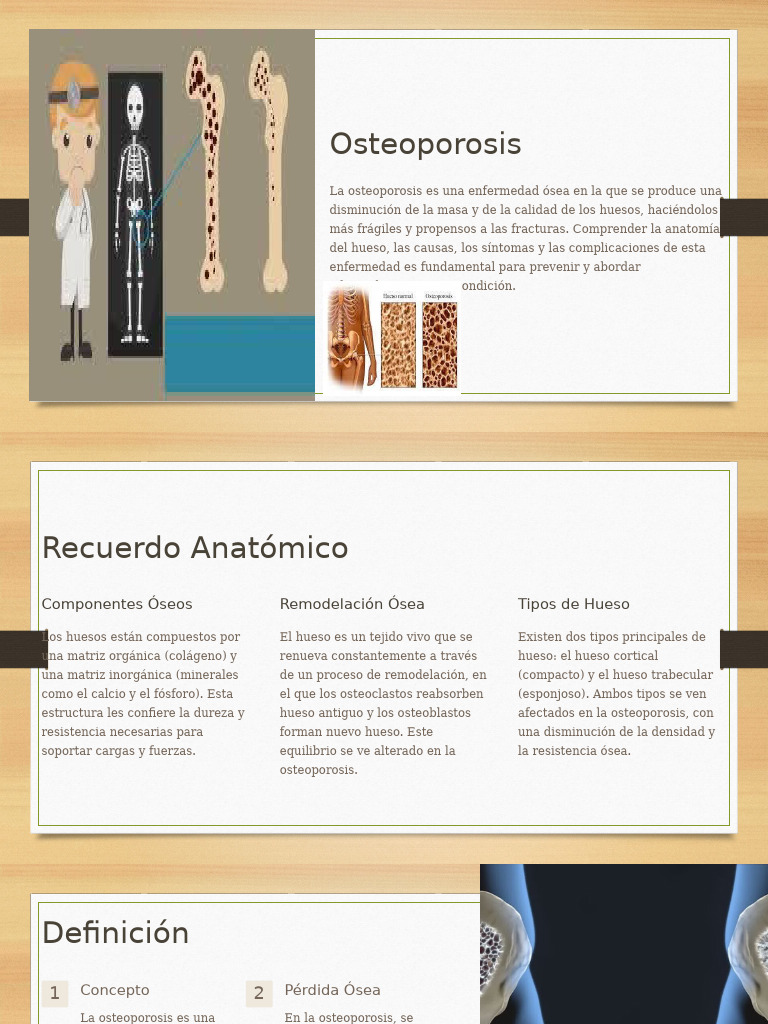 Guía Completa sobre Osteoporosis | PDF | Osteoporosis | Hueso