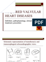 Acquired Valvular Heart Disease