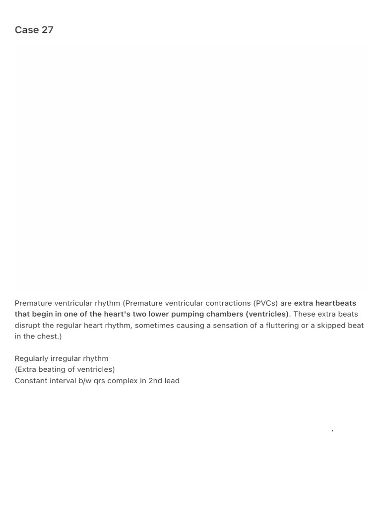 Understanding Premature Ventricular Contractions | PDF