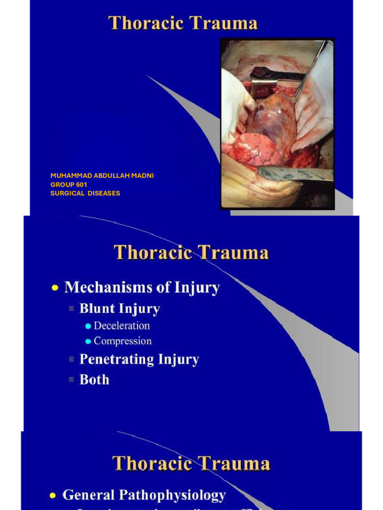 Thoracic Injuries 241125 150210 | PDF