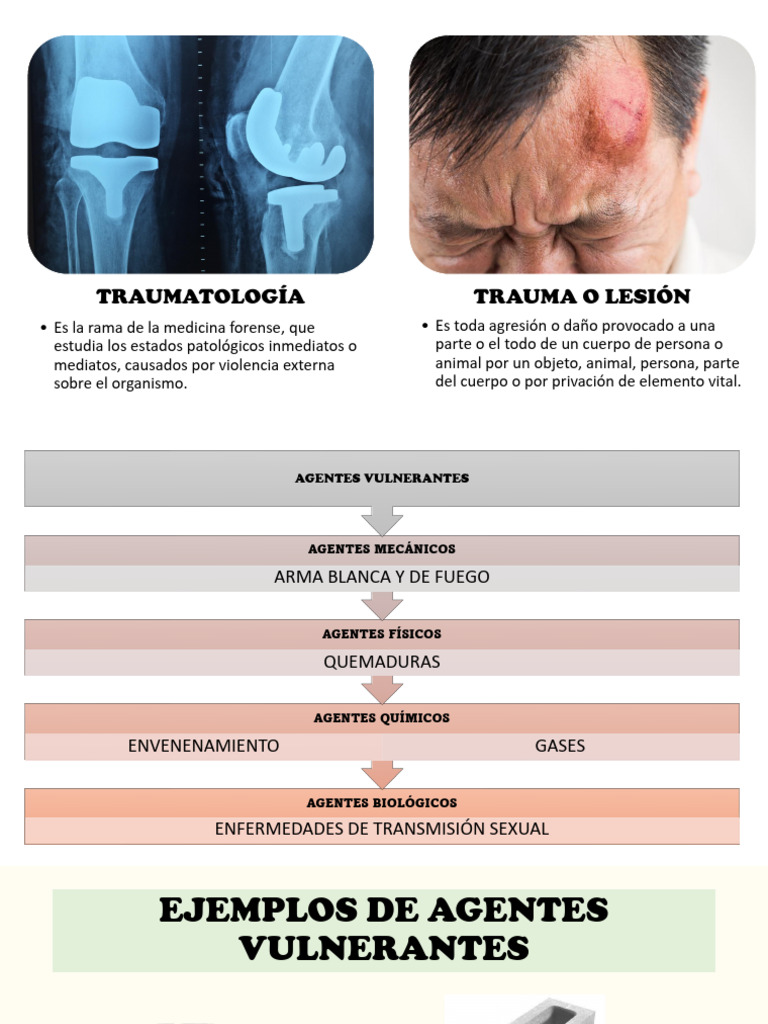 Lesiones y Agentes en Traumatología | PDF