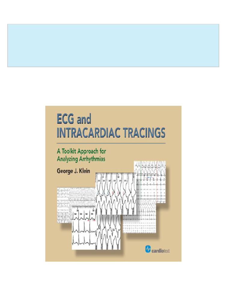 Download Full ECG and Intracardiac Tracings A Toolkit Approach for ...