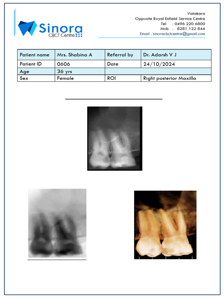 Endodontic CBCT Report for Tooth 16 | PDF | Dentistry Branches | Dentistry