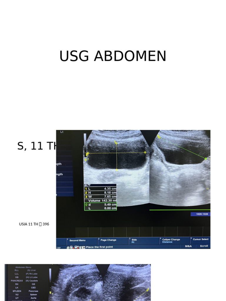 USG MG 3 Presentation2 | PDF