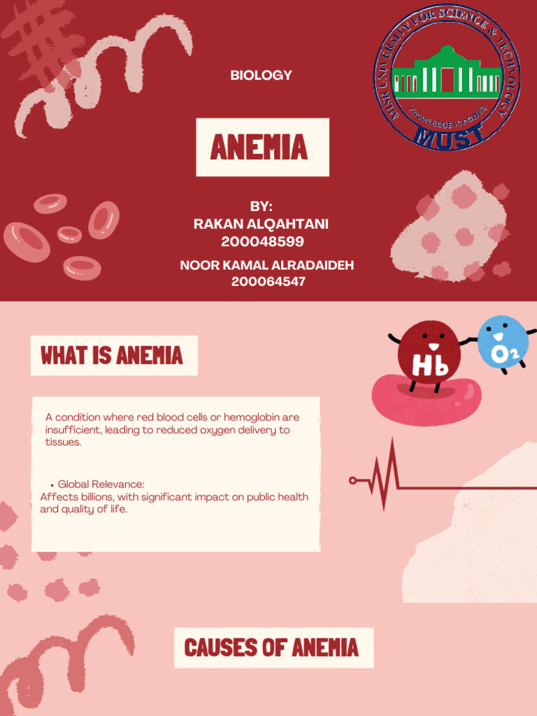 anemia updated | PDF | Anemia | Diseases And Disorders