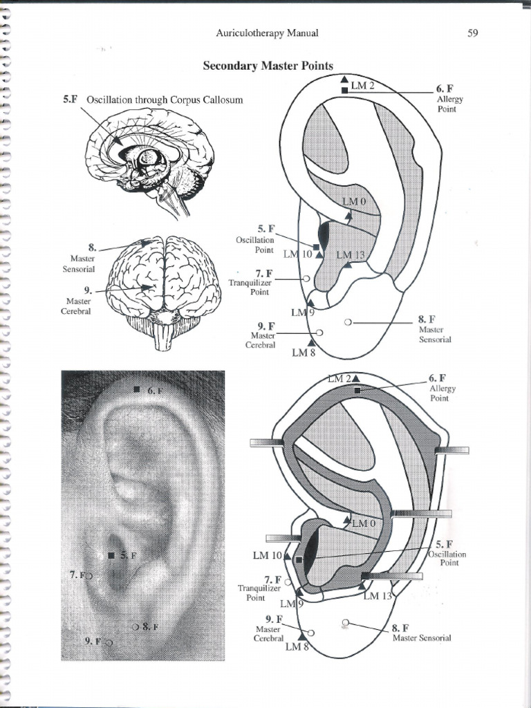 Auricular 001 | PDF