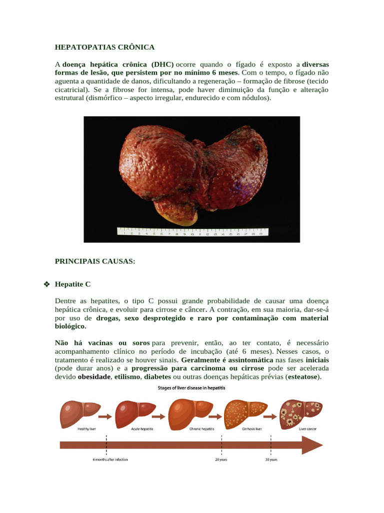 HEPATOPATIAS CRÔNICA | PDF | Cirrose | Hepatite