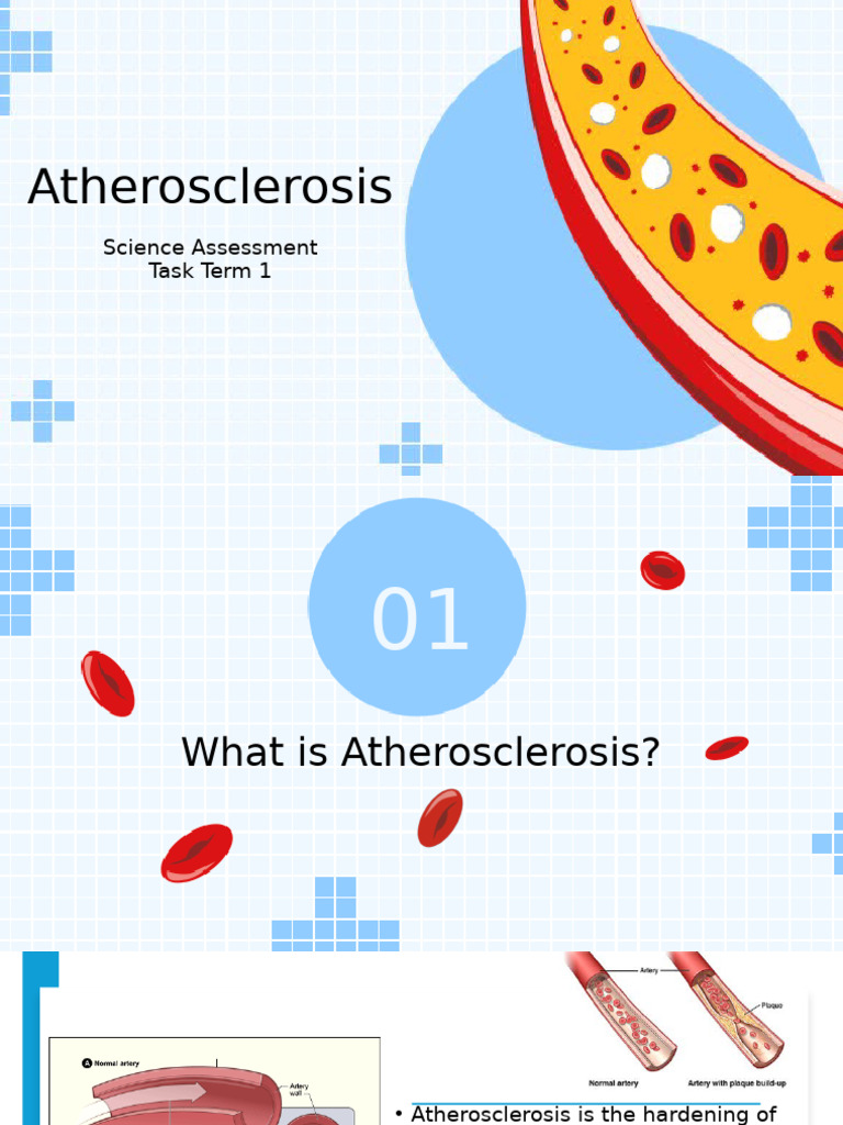 Atherosclerosis Arisha Umair | PDF | Atherosclerosis | Myocardial ...