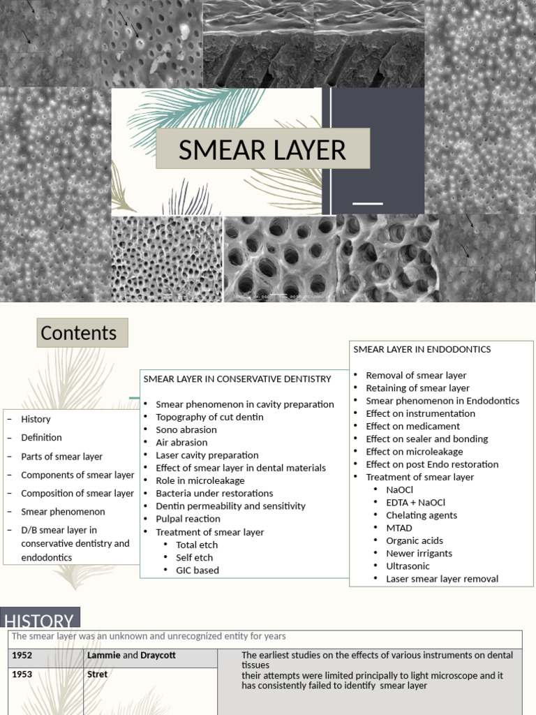 Understanding the Smear Layer in Dentistry | PDF | Dentin | Dentistry ...