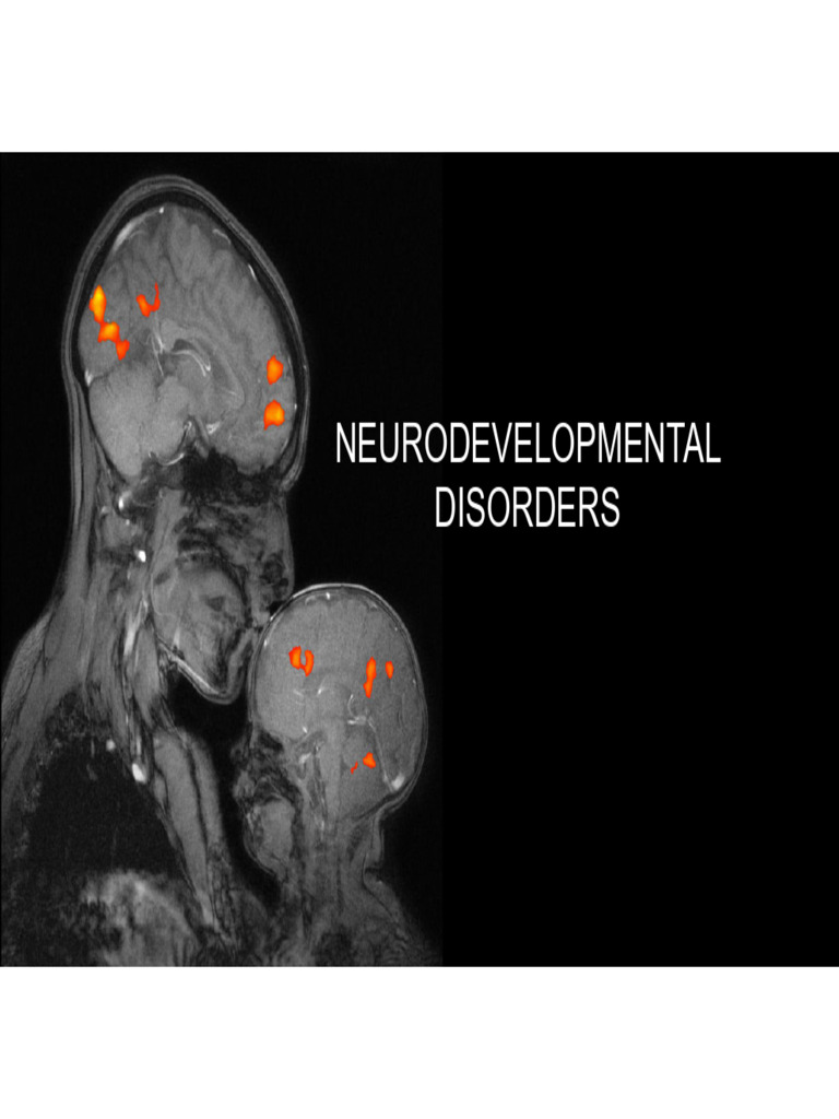 Lecture 18 - Developmental Disorders - Slides | PDF | Autism Spectrum ...