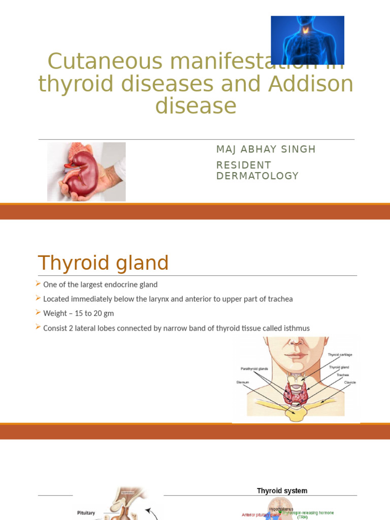 Skin Signs of Thyroid & Addison Diseases | PDF | Thyroid | Hyperthyroidism