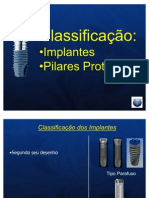 classificação e tipos de implantes