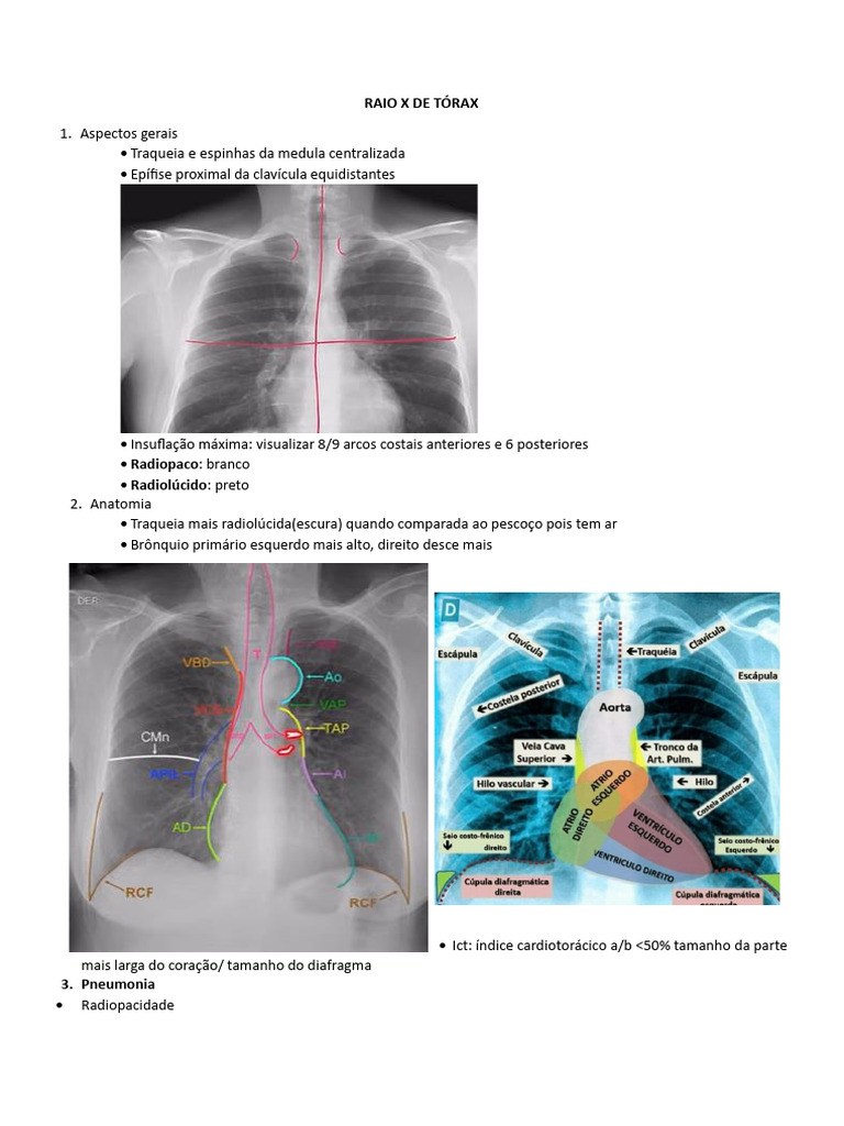 Raio X de Tórax - 241211 - 115722 | PDF | Anatomia humana | Sistema ...