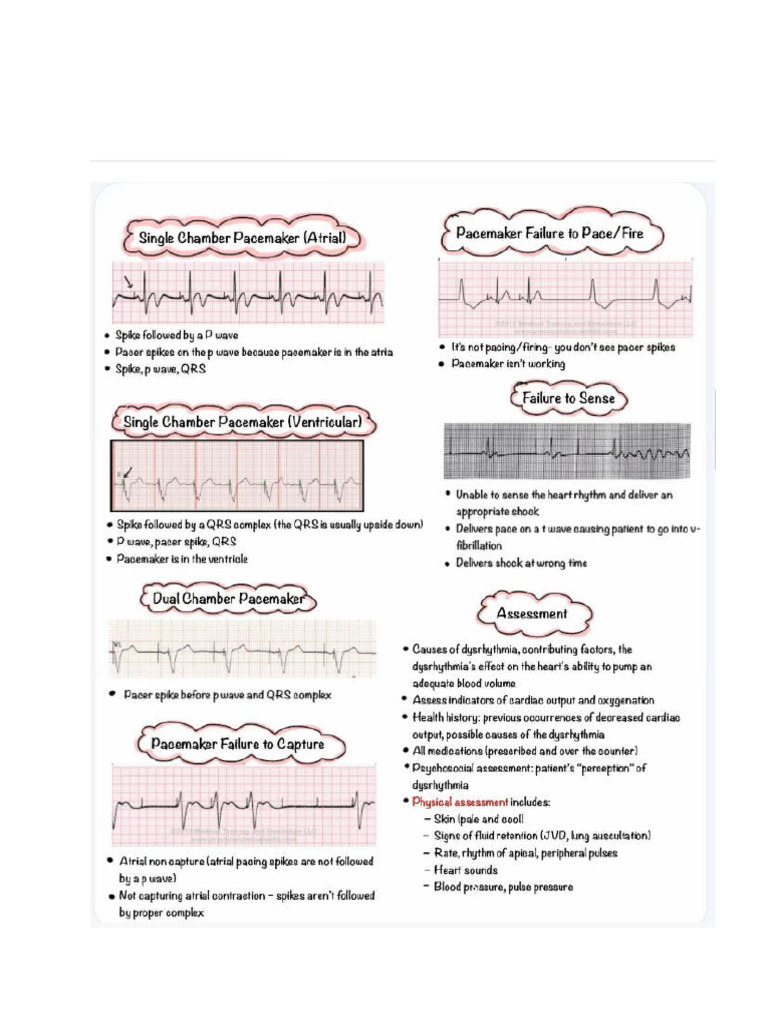 EKG Rythms Part 4 | PDF