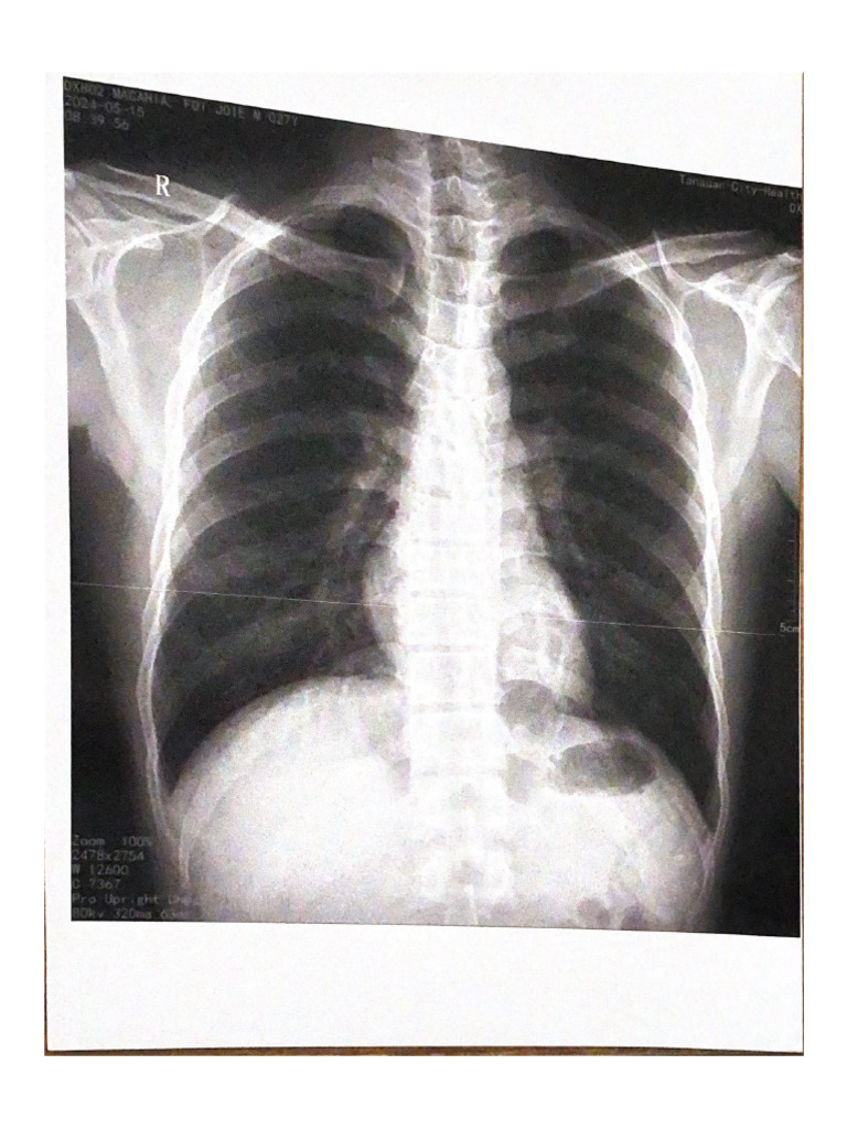 Xray | PDF