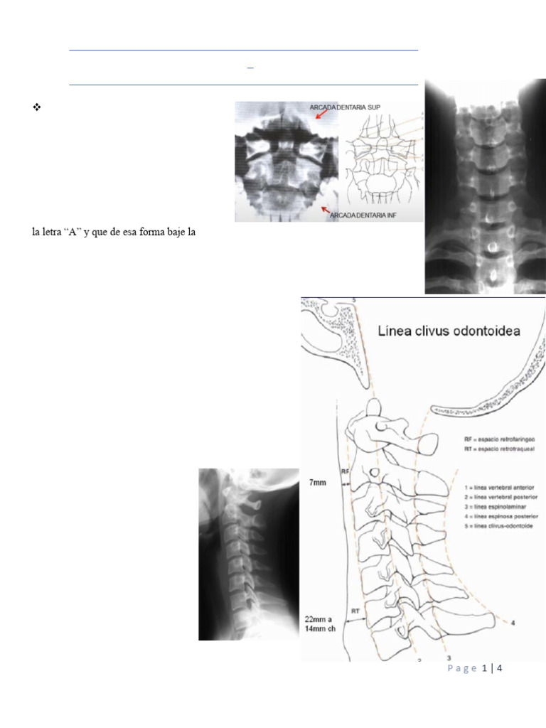 Evaluación Radiológica de la Columna Vertebral | PDF | La columna ...