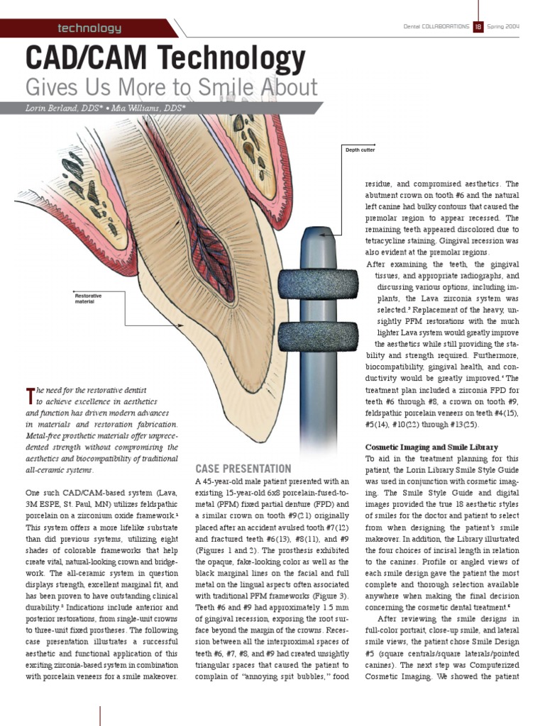 Lava Cad Cam Technology | PDF