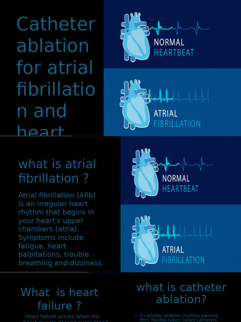 Catheter Ablation in Heart Failure Patients | PDF | Heart | Heart Failure