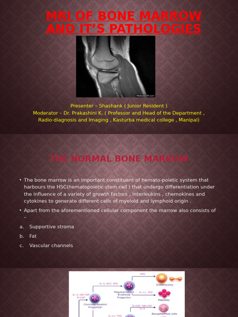 MRI Bone Marrow Pathologies Guide | PDF | Bone Marrow | Bone