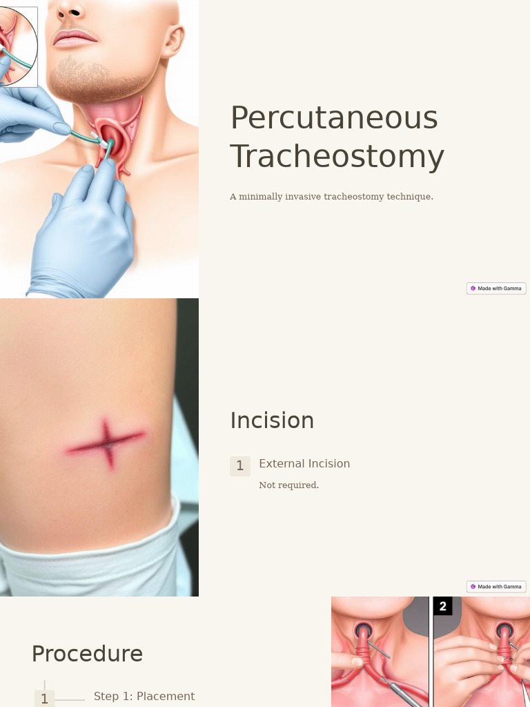Percutaneous Tracheostomy: A Minimally Invasive Tracheostomy Technique ...