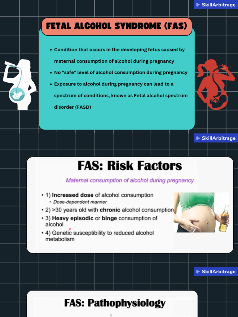 Understanding Fetal Alcohol Syndrome | PDF