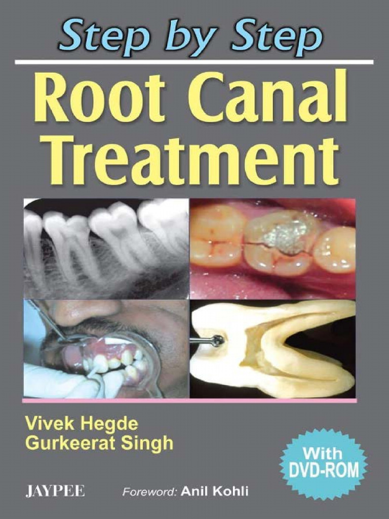 Step by Step Root Canal Treatment рос | PDF