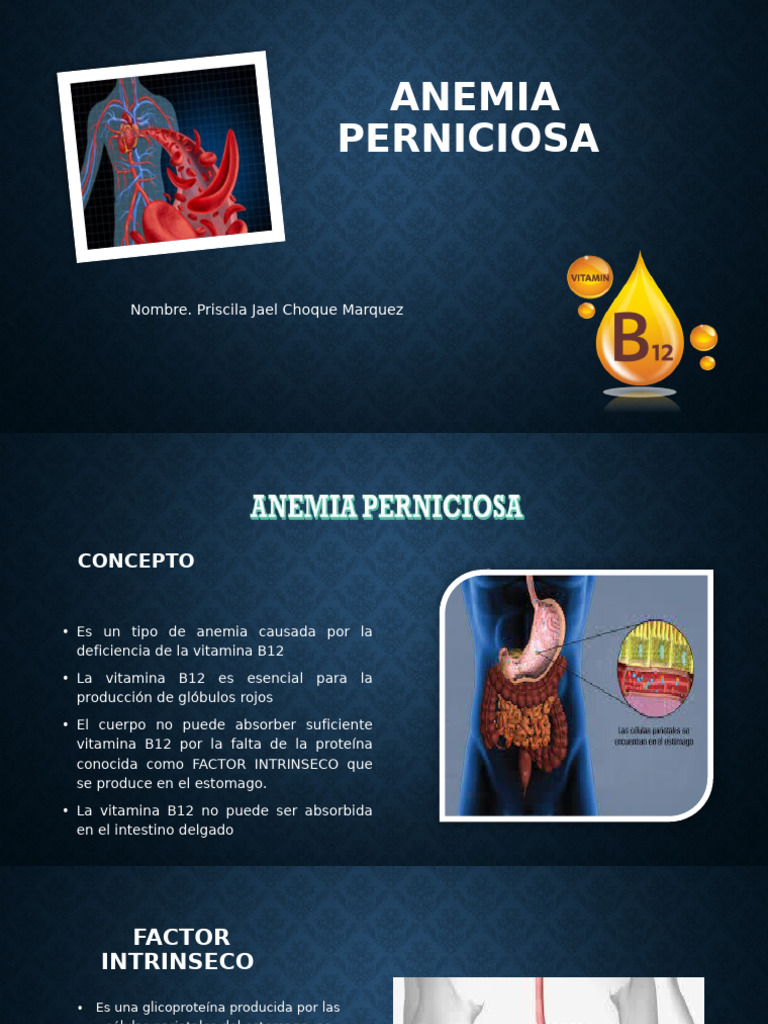 Anemia Perniciosa: Causas y Tratamiento | PDF | Vitamina B12 ...
