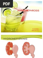 Download HYDRONEPHROSIS by Eureka Rathinam SN80517767 doc pdf