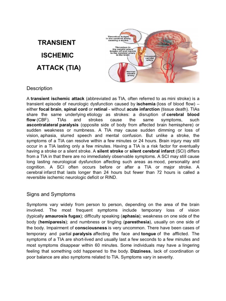 Tia case presentation picture