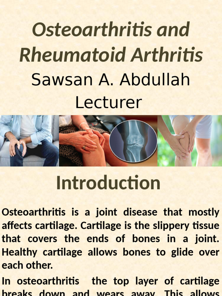 Lecture-4 - Osteoarthritis and RA | PDF | Osteoarthritis | Rheumatoid ...