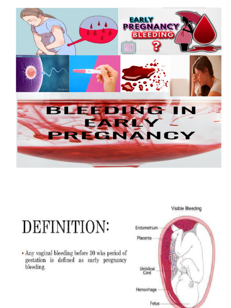 Bleeding in Early Pregnancy | PDF