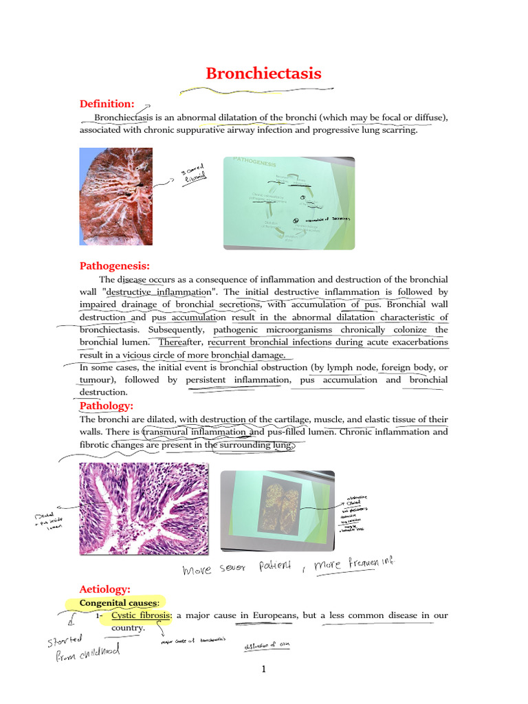 Understanding Bronchiectasis: Causes & Treatment | PDF | Pneumonia ...