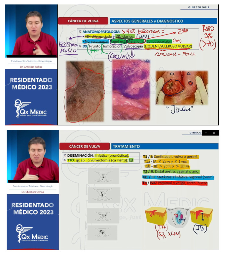 Fcard Gineco QX Medic | PDF