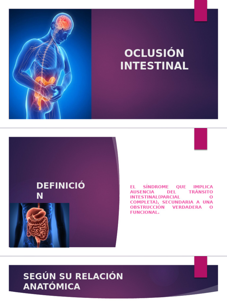 Oclusion Intestinal | PDF