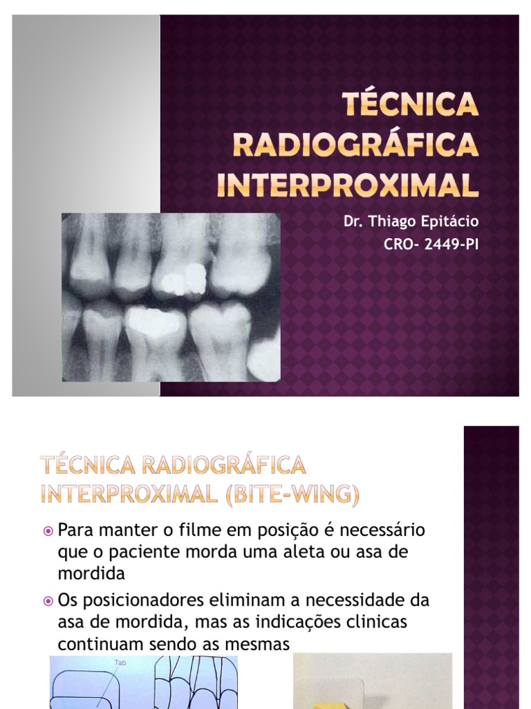 Técnica Radiográfica Interproximal | PDF