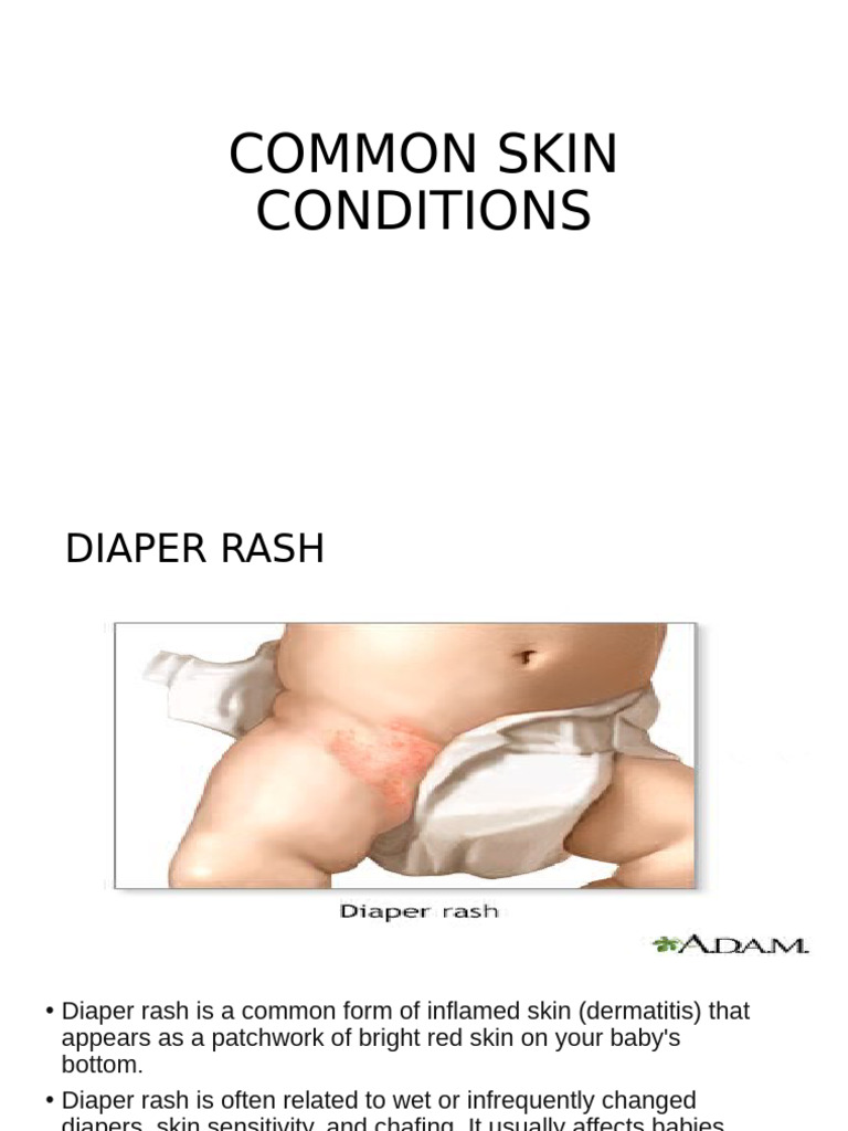 Common Skin Condition | PDF | Dermatitis | Diseases And Disorders